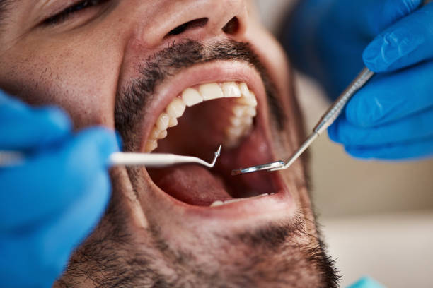 Best Emergency Dental Care for Abscessed Tooth in Waverly, MI