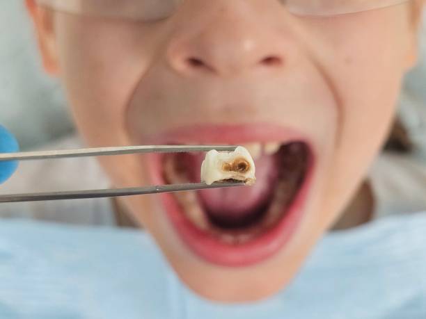 Best Orthodontic Emergency Dentist in Waverly, MI